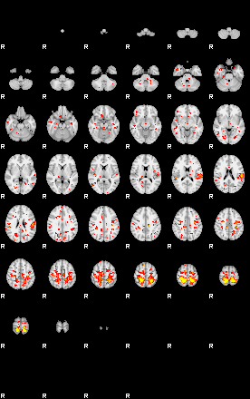 Patient:33;component:55