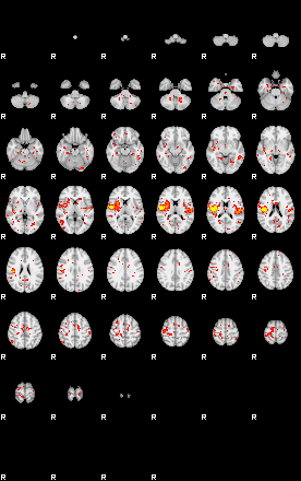 Patient:33;component:71