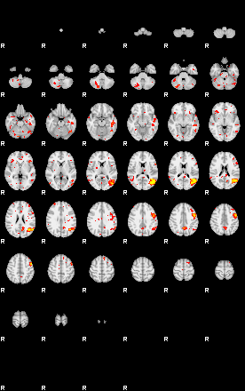 Patient:34;component:107