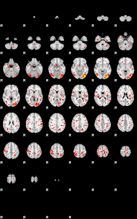 Patient:34;component:111