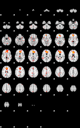 Patient:34;component:125