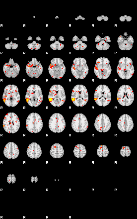 Patient:34;component:131