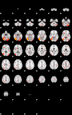 Patient:34;component:143