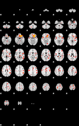 Patient:34;component:144