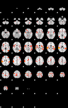 Patient:34;component:150