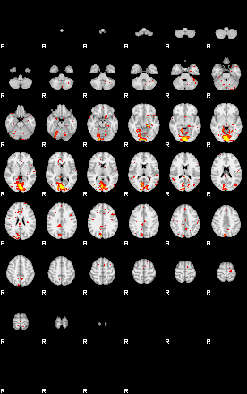 Patient:34;component:30