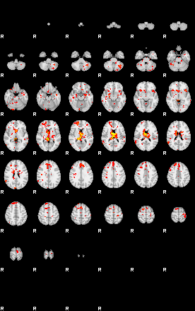 Patient:34;component:47