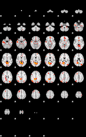 Patient:34;component:5