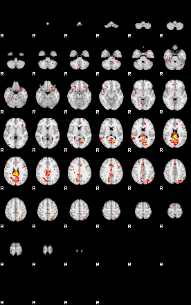 Patient:34;component:53