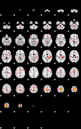 Patient:34;component:55