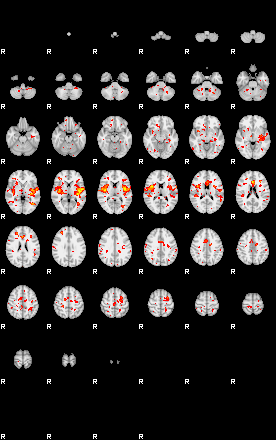 Patient:34;component:90