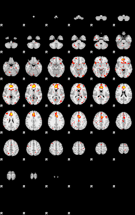 Patient:35;component:105