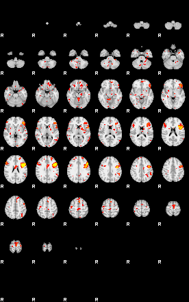 Patient:35;component:109