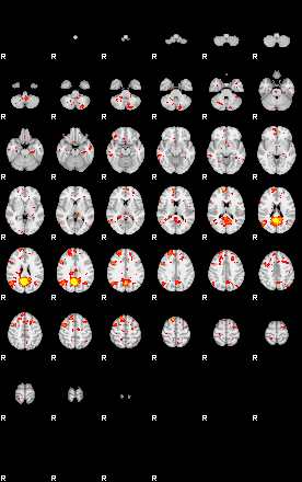 Patient:35;component:142