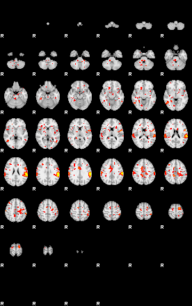 Patient:35;component:15