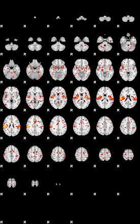 Patient:35;component:150