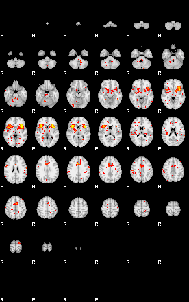 Patient:35;component:151