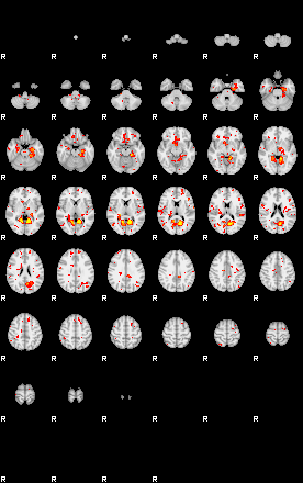 Patient:35;component:161