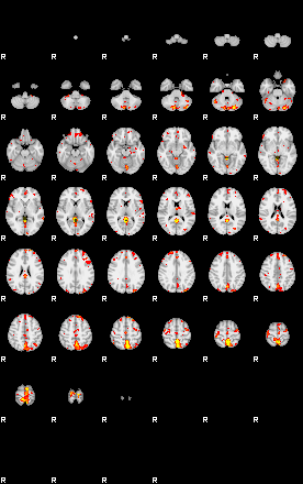 Patient:35;component:166