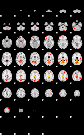 Patient:35;component:180