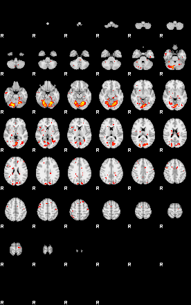 Patient:35;component:191