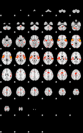 Patient:35;component:195