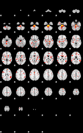 Patient:35;component:32