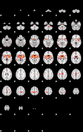 Patient:35;component:39