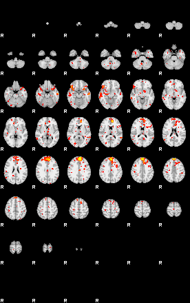 Patient:35;component:44