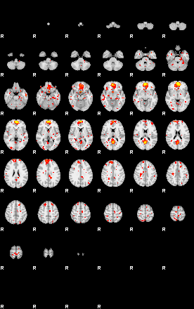 Patient:35;component:49