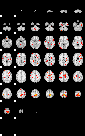 Patient:35;component:55