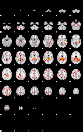 Patient:35;component:57