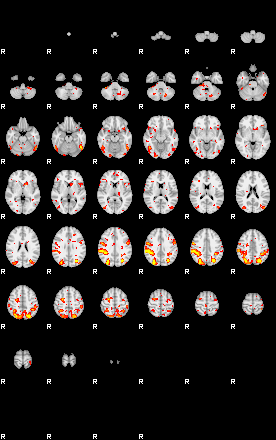 Patient:35;component:60