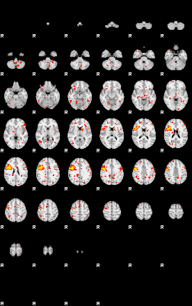 Patient:35;component:75