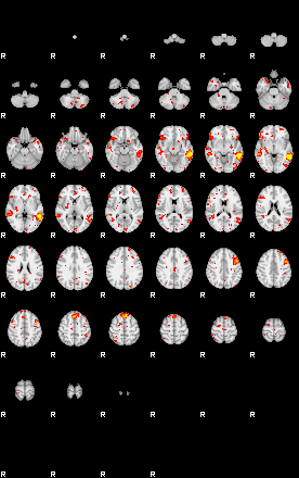 Patient:36;component:10