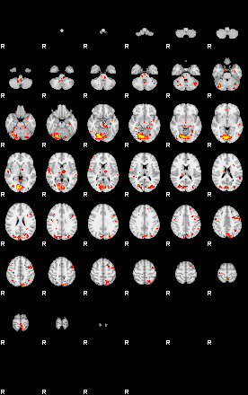 Patient:36;component:30