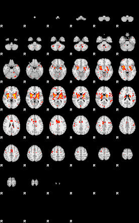 Patient:36;component:39