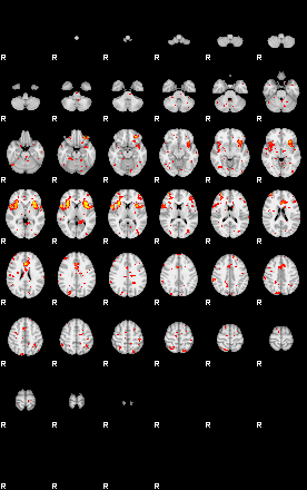 Patient:37;component:151