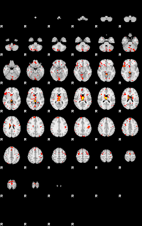 Patient:37;component:47