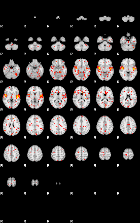 Patient:37;component:58