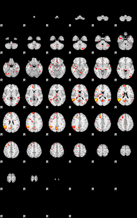 Patient:38;component:100