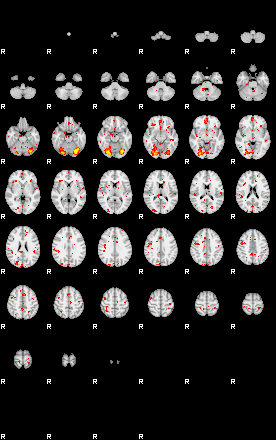 Patient:38;component:122