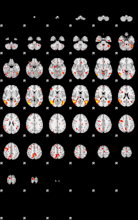 Patient:38;component:142