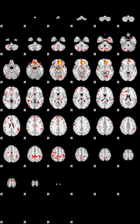 Patient:38;component:144