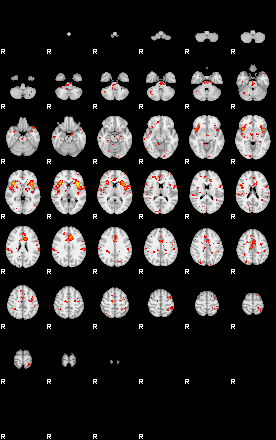 Patient:38;component:150