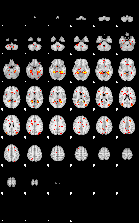 Patient:38;component:161