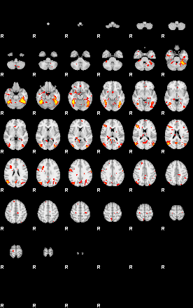 Patient:38;component:165