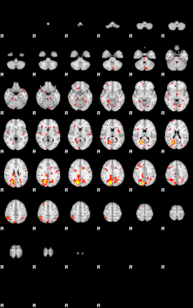 Patient:38;component:182