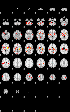 Patient:38;component:39