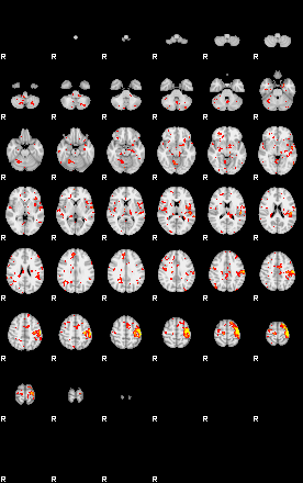 Patient:39;component:101